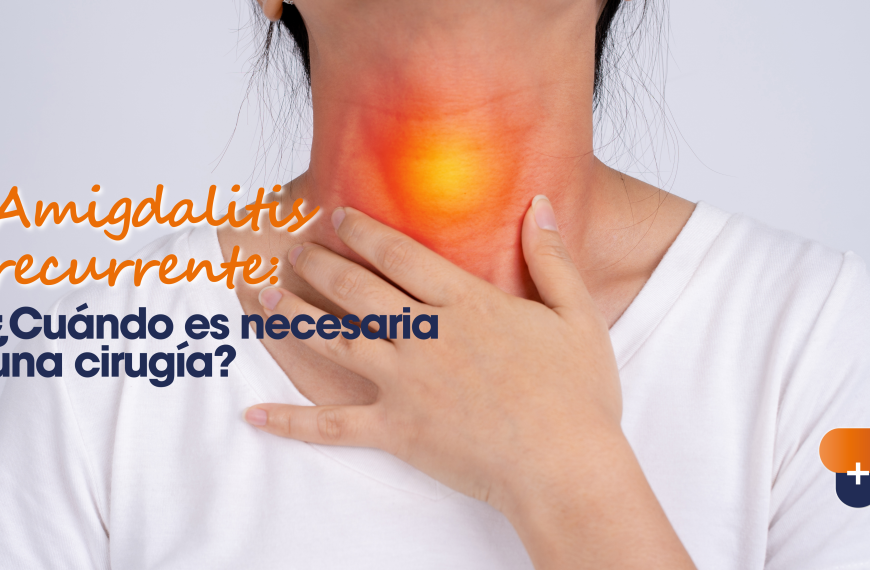 Amigdalitis recurrente: ¿Cuándo es necesaria una cirugía?