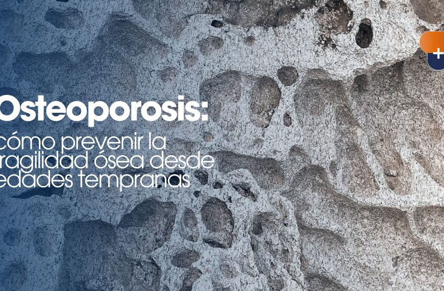 Osteoporosis: cómo prevenir la fragilidad ósea desde edades tempranas