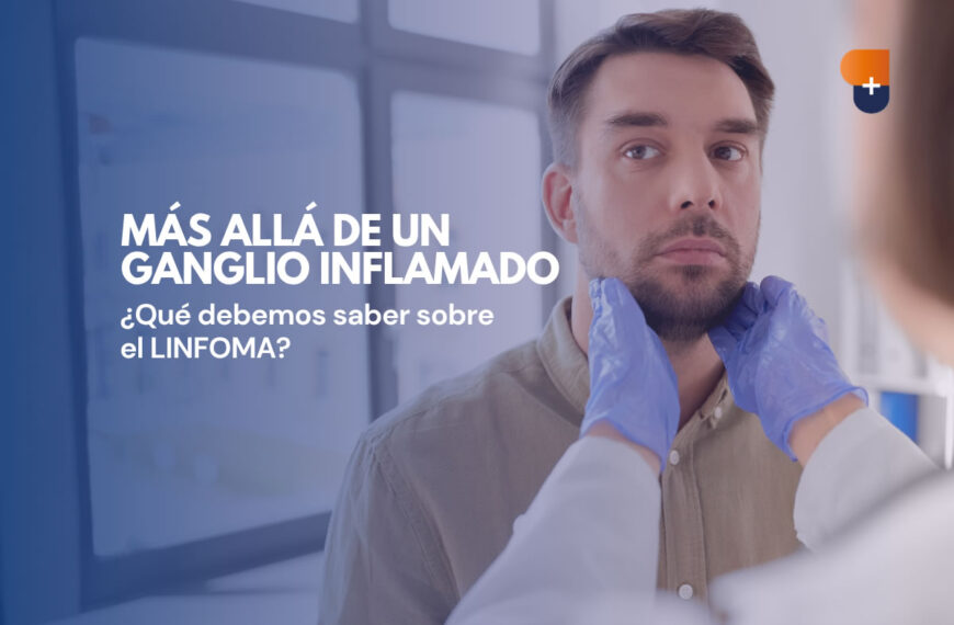 Más allá de un ganglio inflamado: ¿qué debemos saber sobre el linfoma?